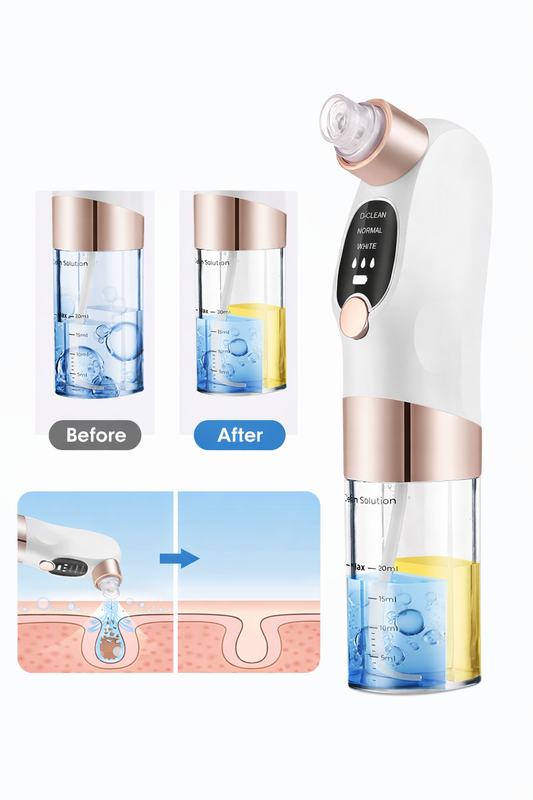 NOVΛ Care Electric Blackhead Remover